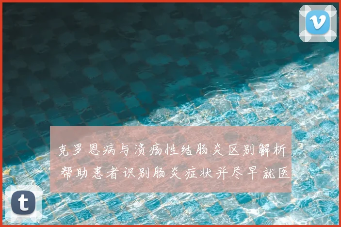 克罗恩病与溃疡性结肠炎区别解析 帮助患者识别肠炎症状并尽早就医